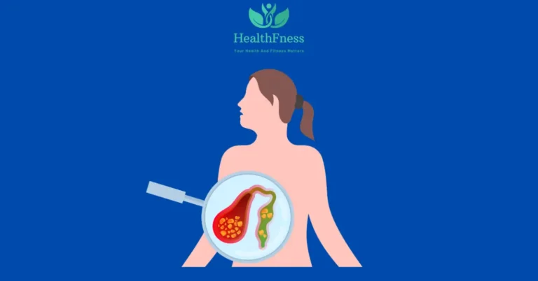 Acute Pancreatitis ICD 10