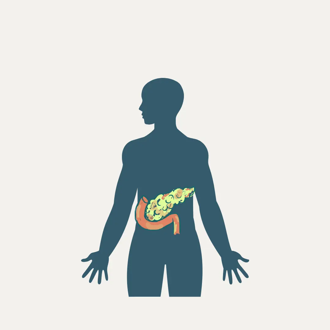 acute-pancreatitis-icd-10-challenges-the-victory-path-healthfness