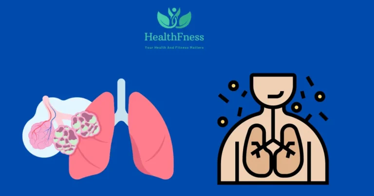 Cystic Fibrosis ICD 10