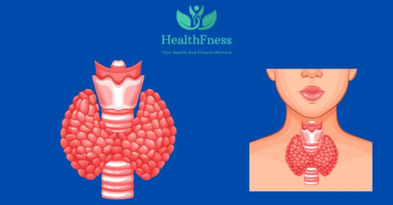Hyperparathyroidism ICD 10