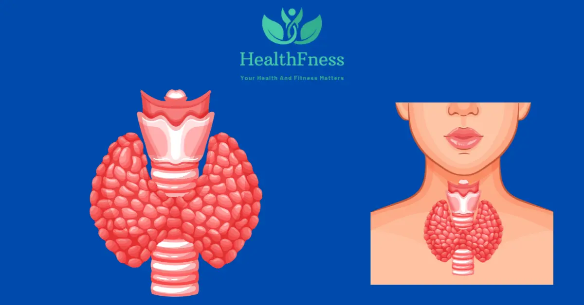 Understanding Hyperparathyroidism ICD 10: Symptoms, Causes, and Treatments Hyperparathyroidism ICD 10