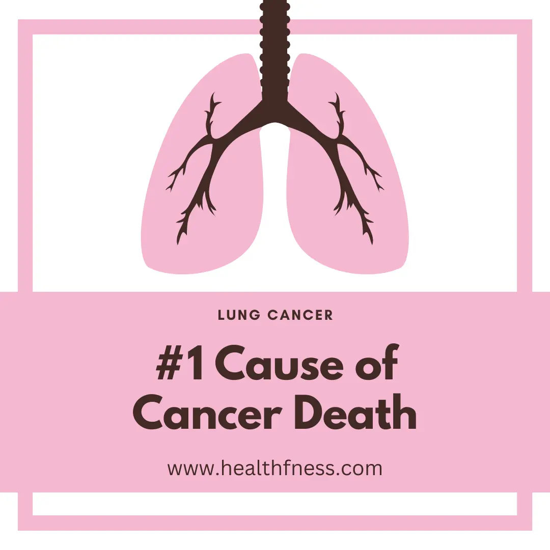Lung Cancer ICD 10: Understanding The Code, Diagnosis And Treatment Lung Cancer ICD 10