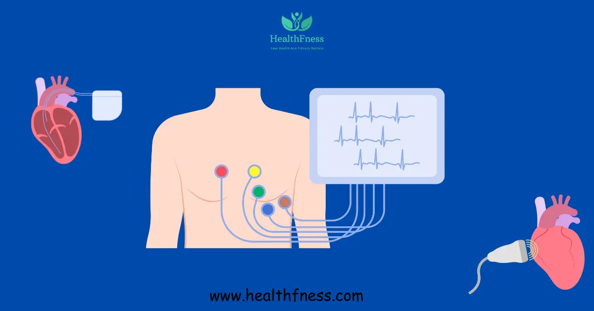 What Are The 4 Stages Of Congestive Heart Failure: From Stage 1 to Stage 4 "An electrocardiogram (ECG) machine displaying a heart rhythm trace on its screen, with a human heart illustration in the background, showing the correlation between the heart's electrical activity and the ECG output."