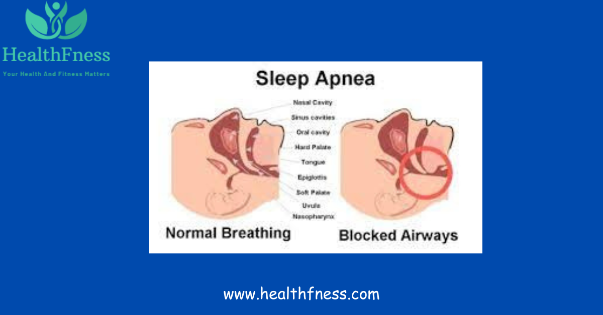 An illustration showing the ideal sleeping position for maximum breathing, with the subject resting on their side and pillows supporting their upper body.