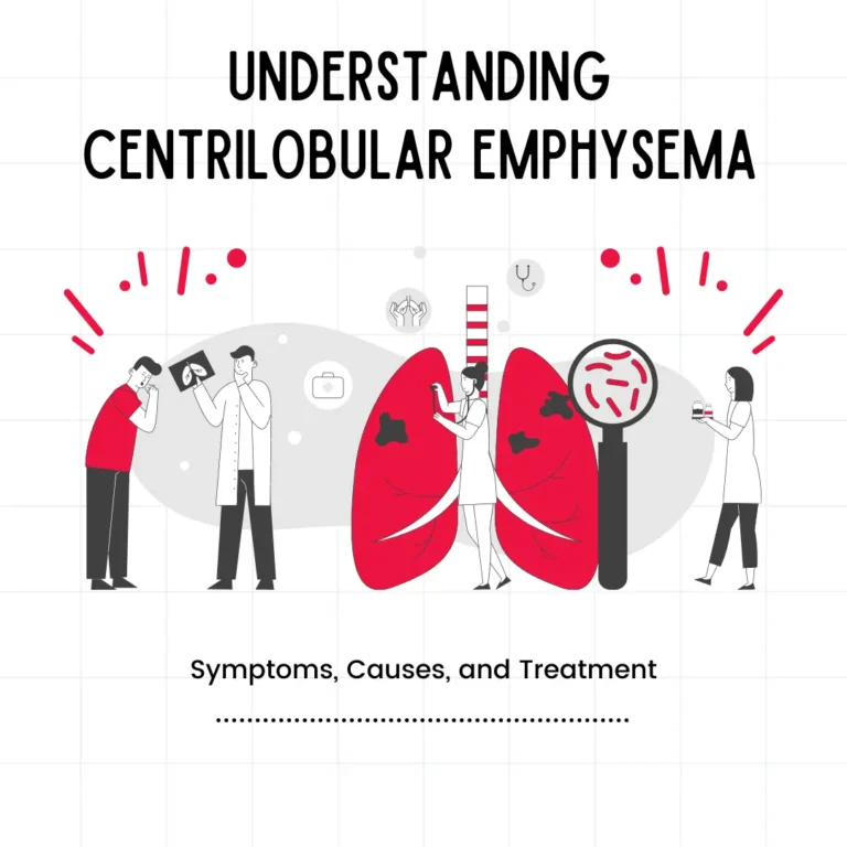 "Close-up view of lung tissue showing characteristic centrilobular emphysema pattern: damaged air sacs in central portions of lobules, often associated with smoking."