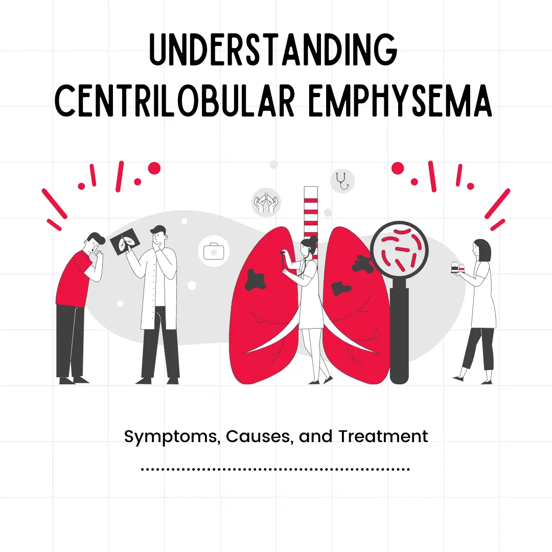 "Close-up view of lung tissue showing characteristic centrilobular emphysema pattern: damaged air sacs in central portions of lobules, often associated with smoking."