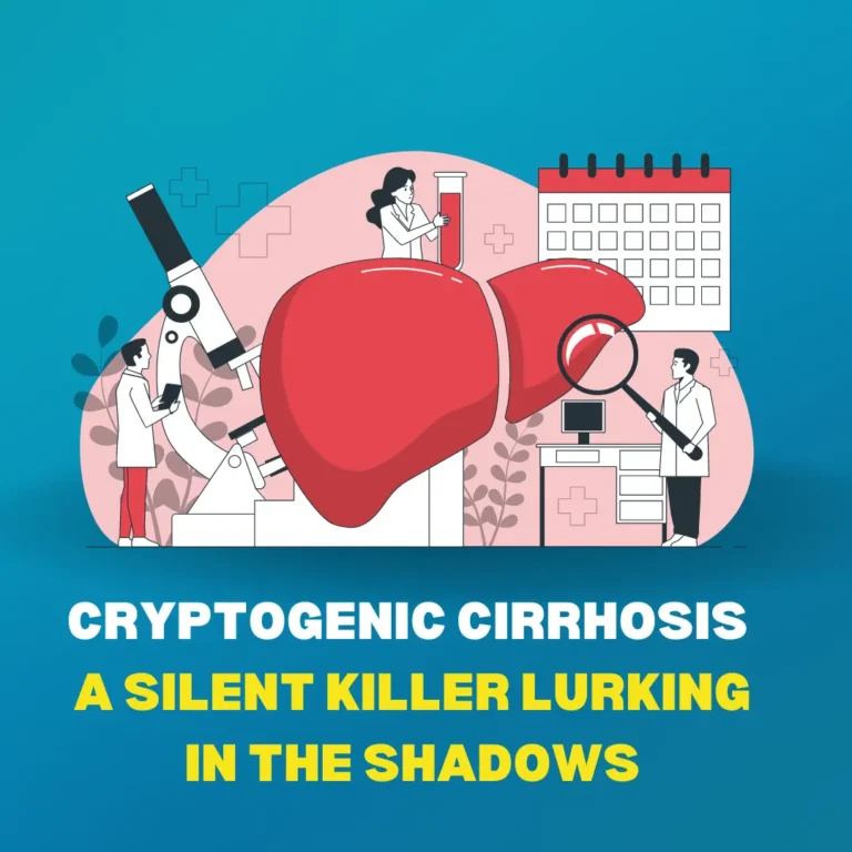 "An illustration depicting the concept of cryptogenic cirrhosis, representing liver damage of unknown origin. The liver appears scarred and inflamed, symbolizing the silent progression of the disease."