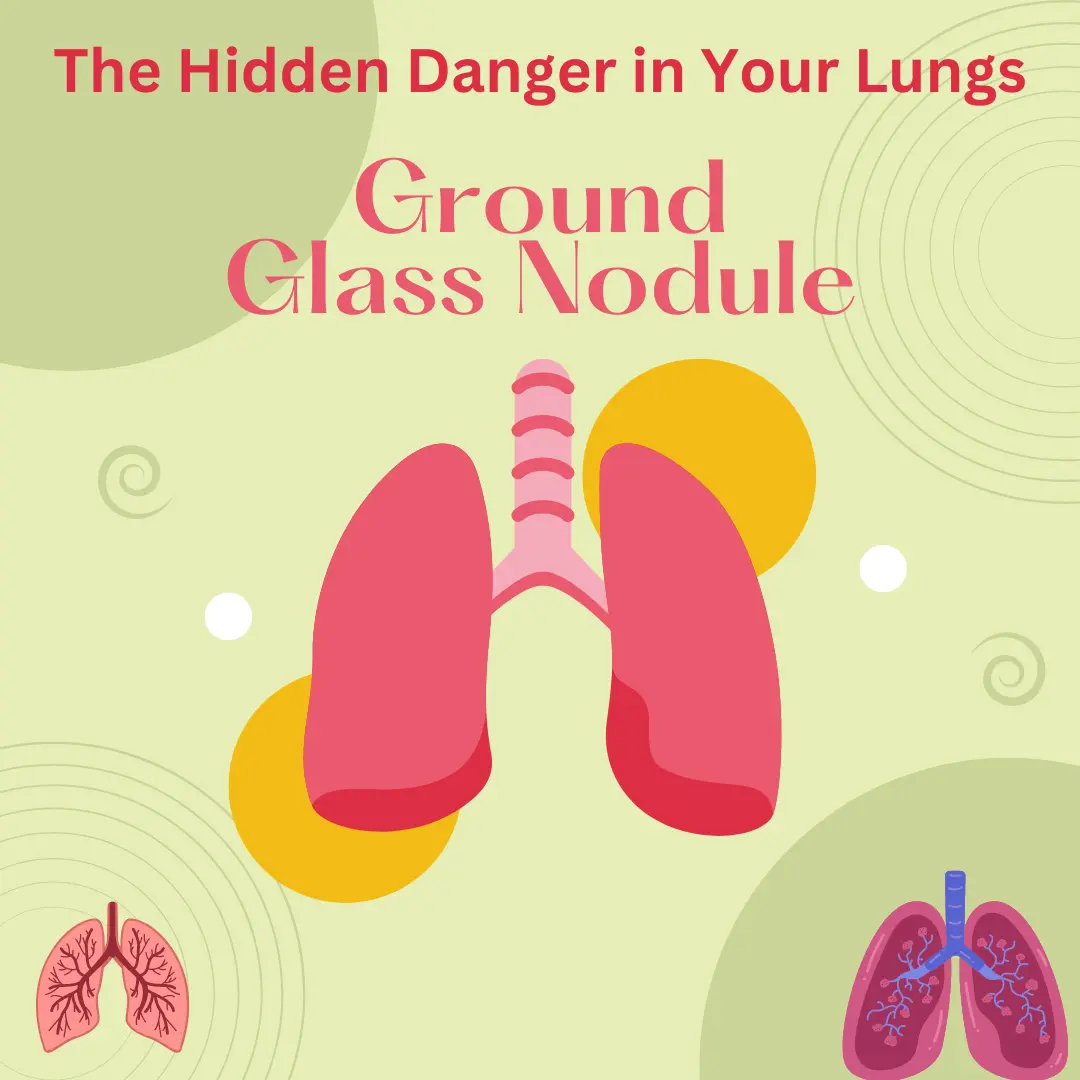 ground-glass-nodule-the-hidden-danger-in-your-lungs-healthfness