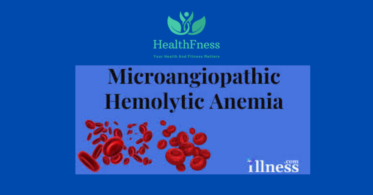 Microangiopathic Hemolytic Anemia: Symptoms, Causes, And Treatment2024 Illustration depicting Microangiopathic Hemolytic Anemia, a condition characterized by way of abnormal red blood mobile destruction due to damage in small blood vessels.