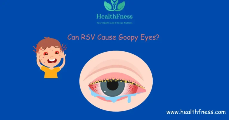 Critical: Can RSV Cause Goopy Eyes? Fact or Myth