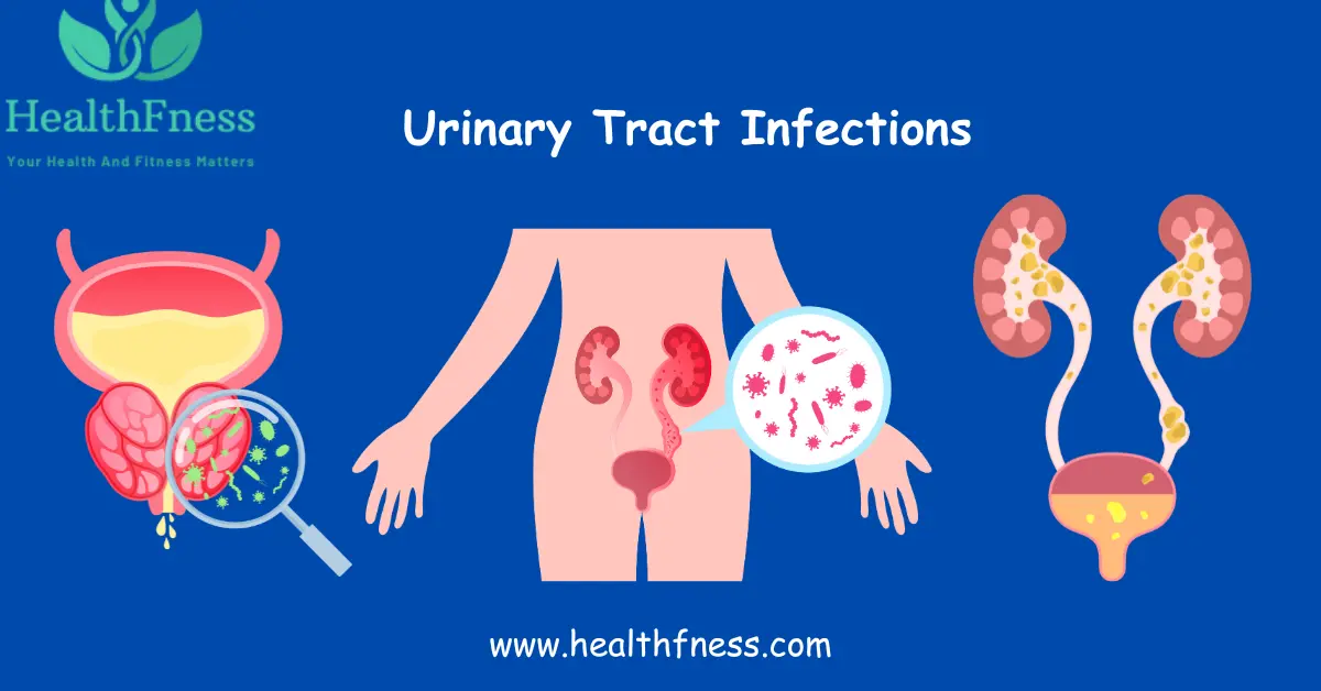 How To Prevent Urinary Tract Infections: Your Roadmap to a Healthier Urinary Tract how to prevent urinary tract infections