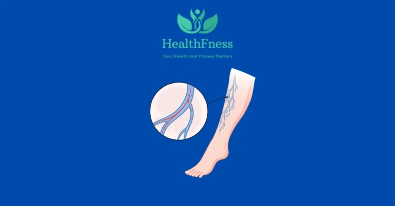 Castor Oil for Varicose Veins