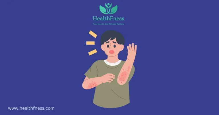 Is Castile Soap Good for Eczema