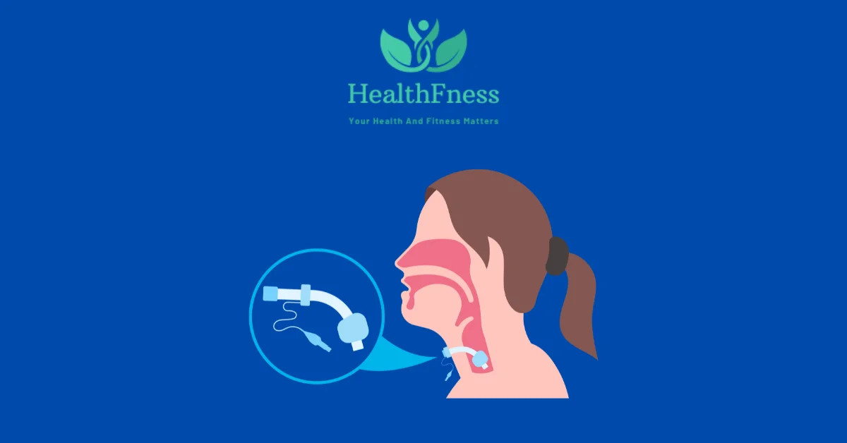 Pros and Cons Of Oral Appliance For Sleep Apnea