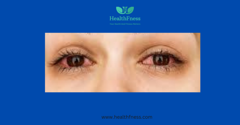 antihistamine eye drops