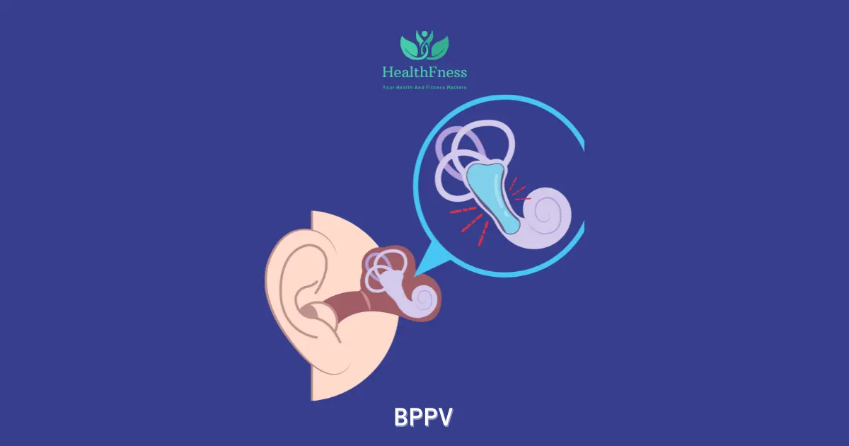 benign paroxysmal positional vertigo unspecified icd 10