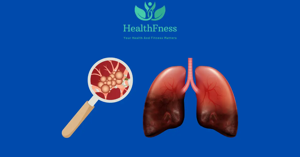 small cell lung cancer paraneoplastic