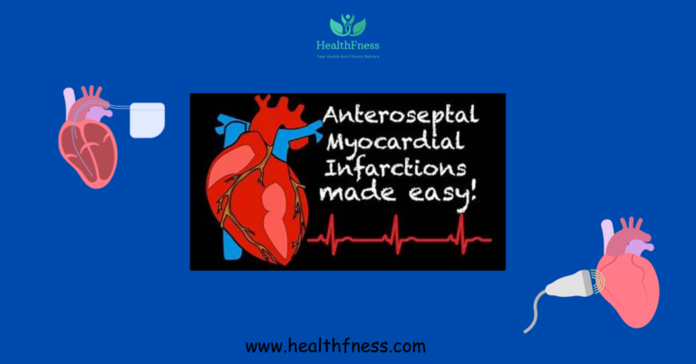 Factors contributing to anteroseptal myocardial infarction, signs and symptoms, and control A blockage inside the left anterior descending (LAD) artery is the purpose of anteroseptal myocardial infarction. Breathing problems, exhaustion, and chest ache are a number of the symptoms. The dreams of treatment are to minimize heart damage and restore blood float. Medications, lifestyle changes, and every so often surgical techniques are used to acquire these dreams.