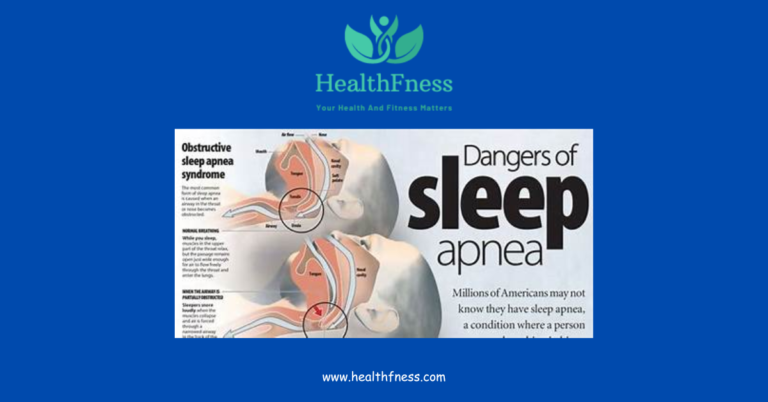we then have an overview of bongo sleep apnea treatments which include the use of CPAP machines, dental sleep apnea appliances and the Bongo device, with all relative benefits a nd drawbacks of each.