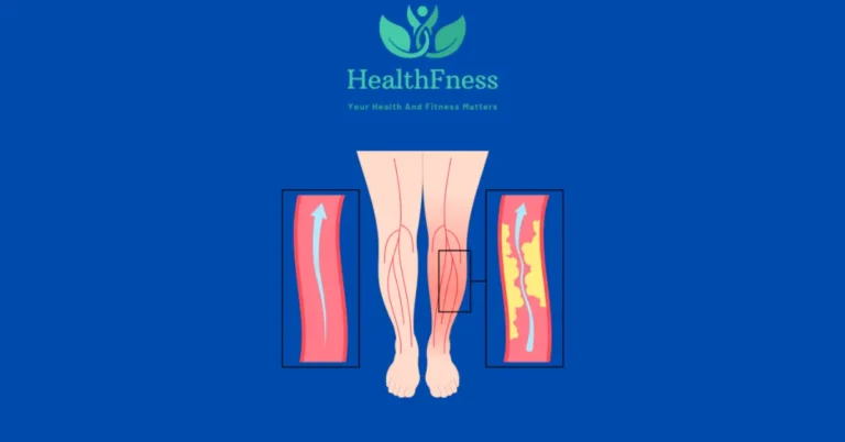 vitamins to take for peripheral disease arteries